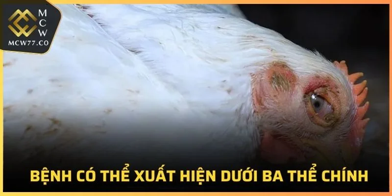 Bệnh có thể xuất hiện dưới ba thể chính