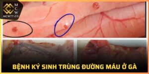 Bệnh Ký Sinh Trùng Đường Máu