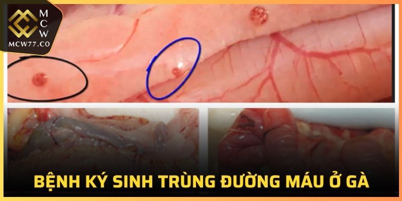 Bệnh Ký Sinh Trùng Đường Máu